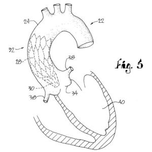 gallery-1466458804-pmx07116-patentoffice17